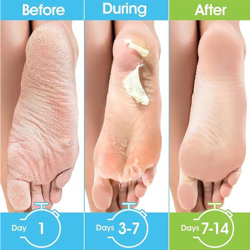 1 Packung = 1 Paar Honig-Fußma – Foot Mask Peeling Bewertung und Preis