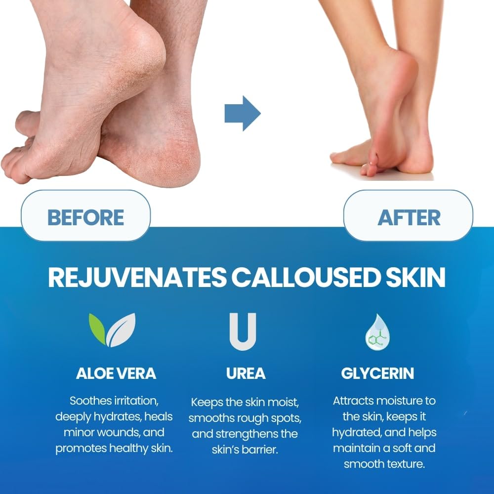 Fußhautentferner für abgestorb – Foot Mask Peeling Bewertung und Preis