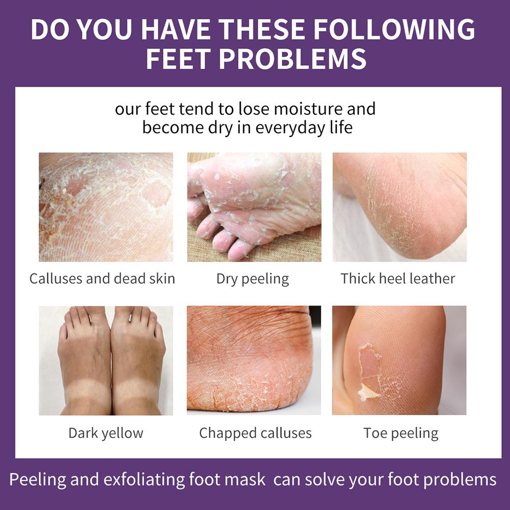 Lavendel-Essenz-Fußmaske, haut – Foot Mask Peeling Bewertung und Preis