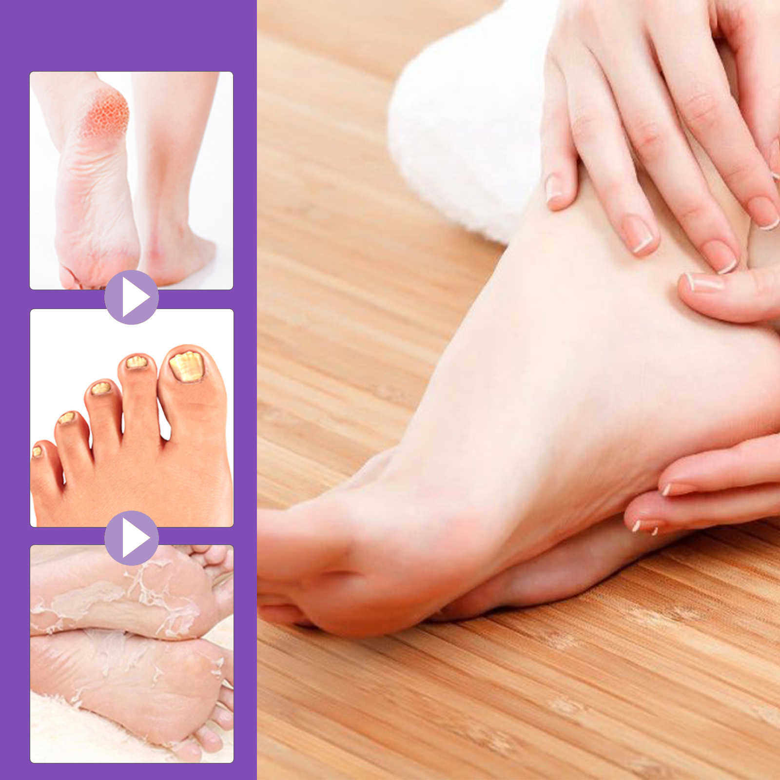 Peeling Fuß maske entfernen ab – Foot Mask Peeling Bewertung und Preis