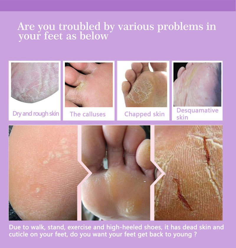 Fußpeeling-Masken, Pediküre-So – Foot Mask Peeling Bewertung und Preis