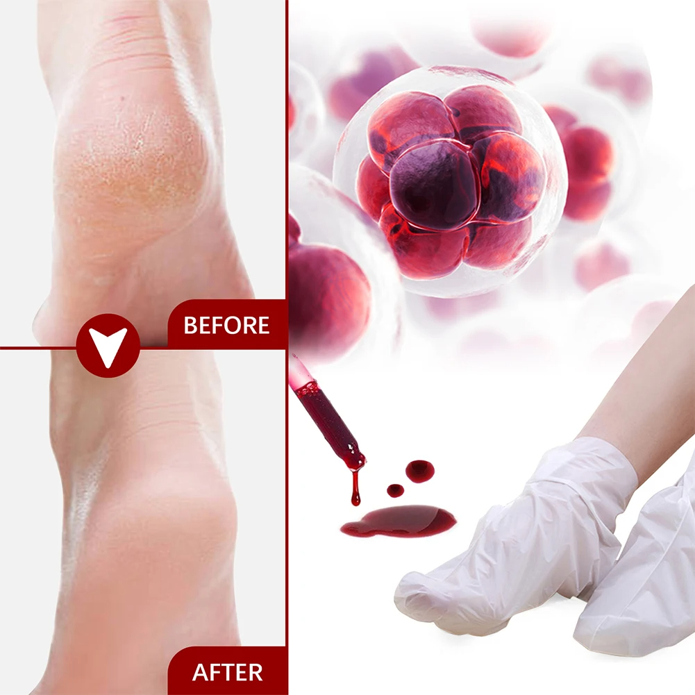 5/2/1 Paar Fußmaske Fruchtsäur – Foot Mask Peeling Bewertung und Preis